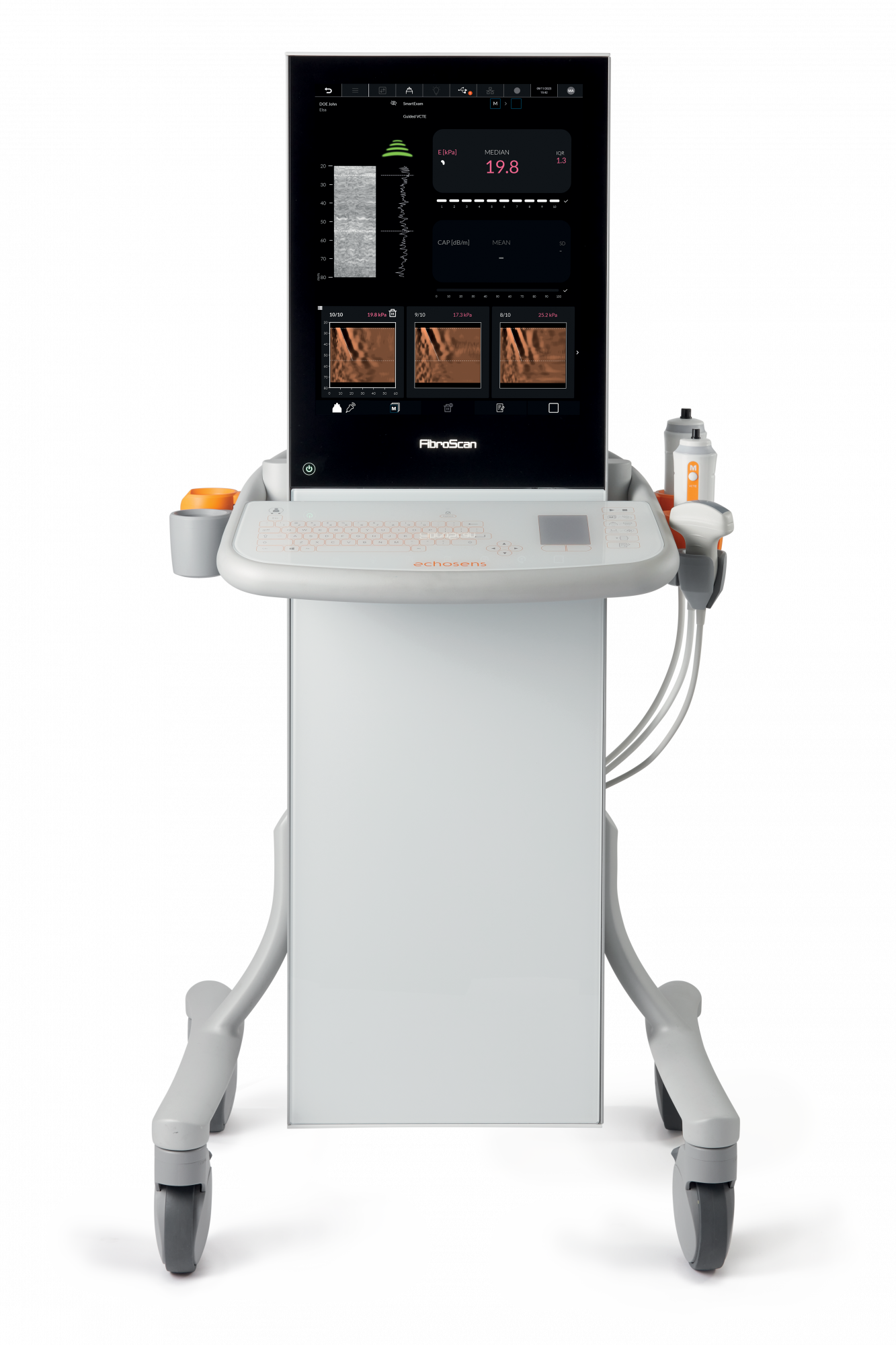Аппарат FibroScan 630 Expert